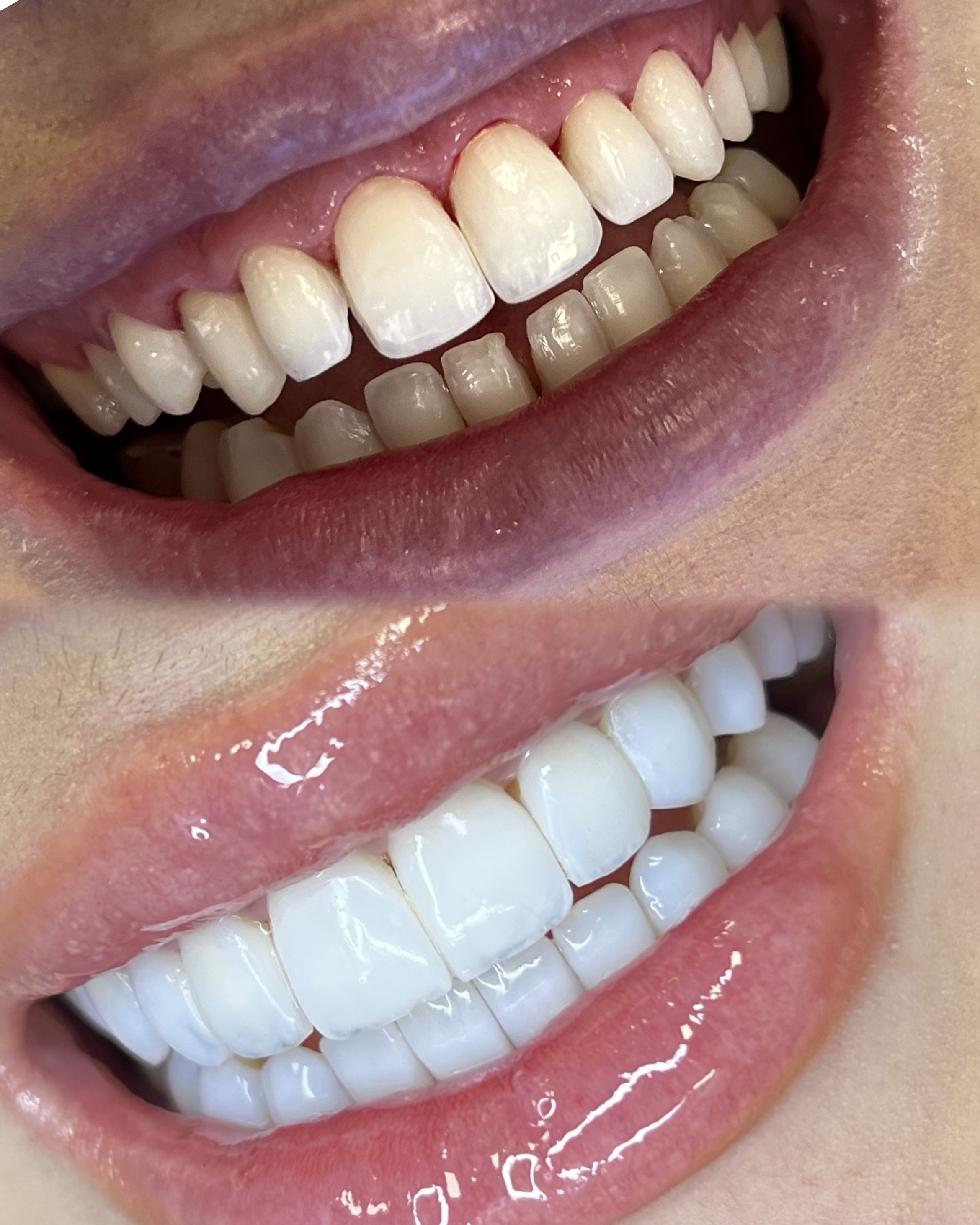 Odontologia estética Curitiba – Dra. Ana Repula
